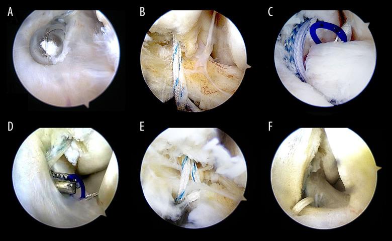 https://cdn.ncbi.nlm.nih.gov/pmc/blobs/519b/7893828/16b87d0f35f7/medscimonit-27-e928526-g003.jpg