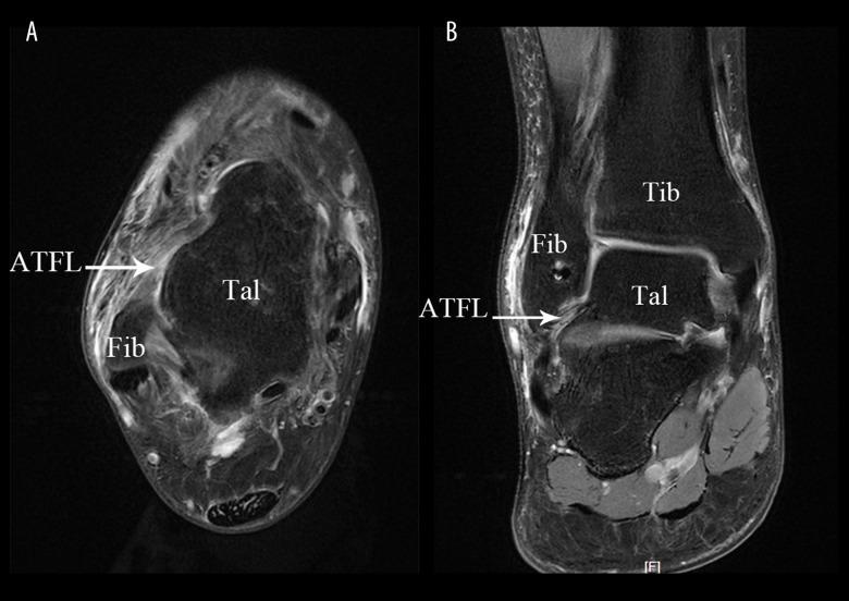 https://cdn.ncbi.nlm.nih.gov/pmc/blobs/519b/7893828/f863935cce4d/medscimonit-27-e928526-g001.jpg