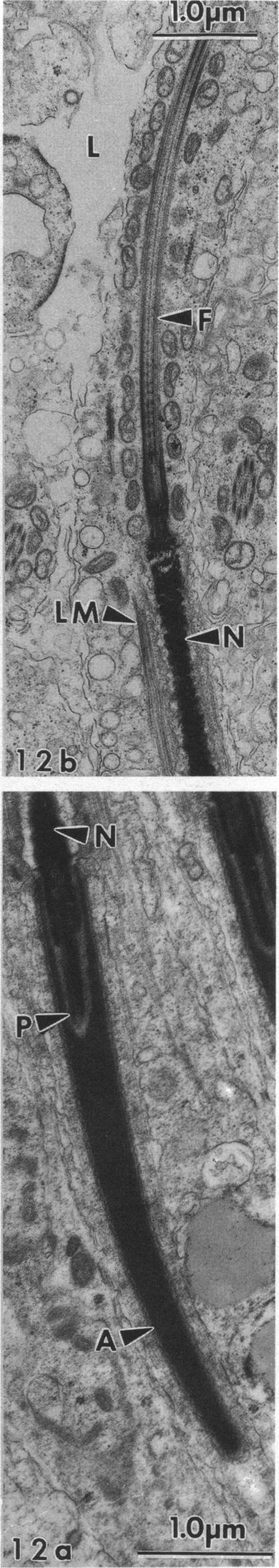 https://cdn.ncbi.nlm.nih.gov/pmc/blobs/51ab/1259878/4986958ba5bb/janat00143-0088-d.jpg