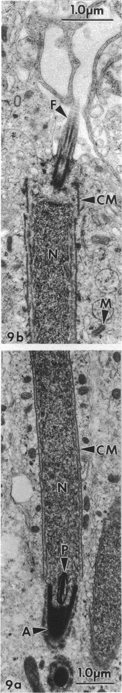https://cdn.ncbi.nlm.nih.gov/pmc/blobs/51ab/1259878/562193b73508/janat00143-0088-a.jpg