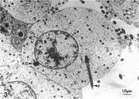 https://cdn.ncbi.nlm.nih.gov/pmc/blobs/51ab/1259878/e6d48e10d4ca/janat00143-0085-a.jpg