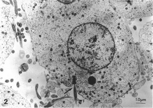 https://cdn.ncbi.nlm.nih.gov/pmc/blobs/51ab/1259878/fe1a404cd1ae/janat00143-0084-b.jpg
