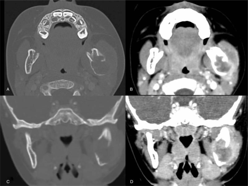 https://cdn.ncbi.nlm.nih.gov/pmc/blobs/51b4/6635274/1380198bbfcc/medi-98-e16331-g005.jpg