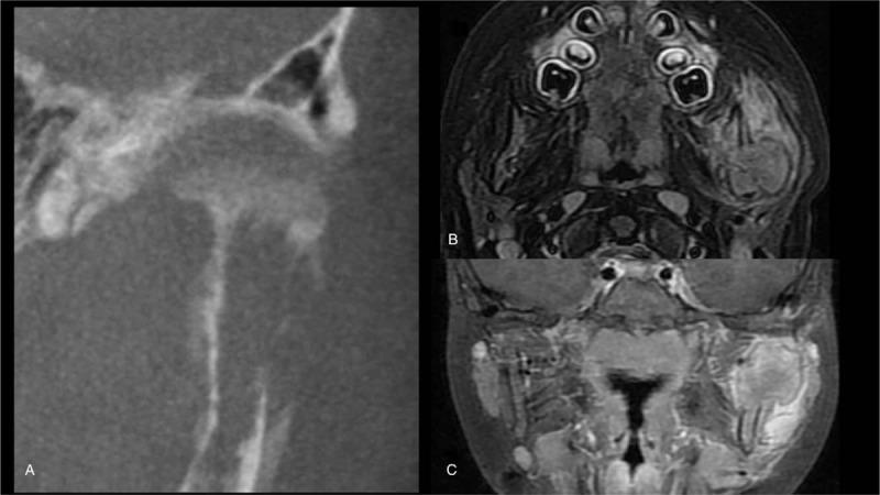 https://cdn.ncbi.nlm.nih.gov/pmc/blobs/51b4/6635274/6255dd41798b/medi-98-e16331-g004.jpg