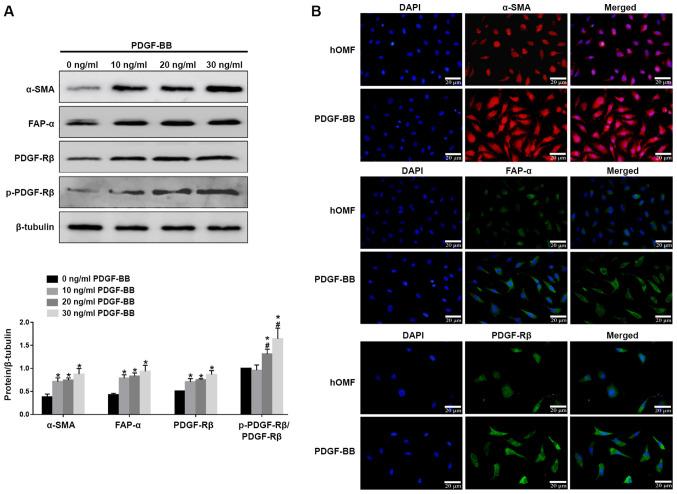 https://cdn.ncbi.nlm.nih.gov/pmc/blobs/51b5/8157341/fec6716b33bd/ol-22-01-12798-g00.jpg