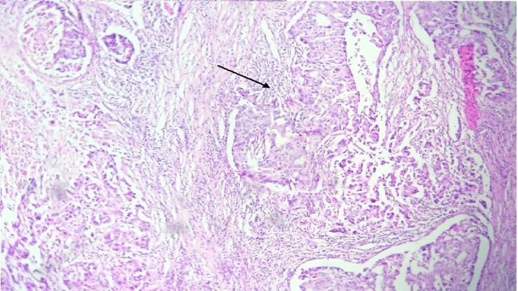 https://cdn.ncbi.nlm.nih.gov/pmc/blobs/51b6/11717322/4fbfe3fd5825/cureus-0016-00000075479-i02.jpg
