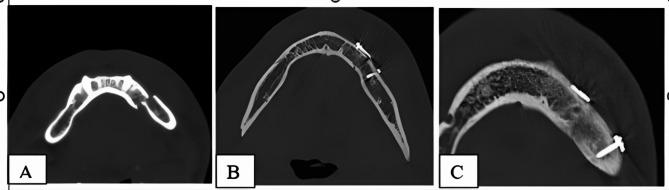https://cdn.ncbi.nlm.nih.gov/pmc/blobs/51b7/12038927/b1dc350d28f3/12903_2025_5935_Fig6_HTML.jpg