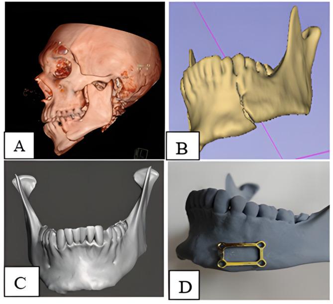 https://cdn.ncbi.nlm.nih.gov/pmc/blobs/51b7/12038927/d9d7459bf7fa/12903_2025_5935_Fig2_HTML.jpg