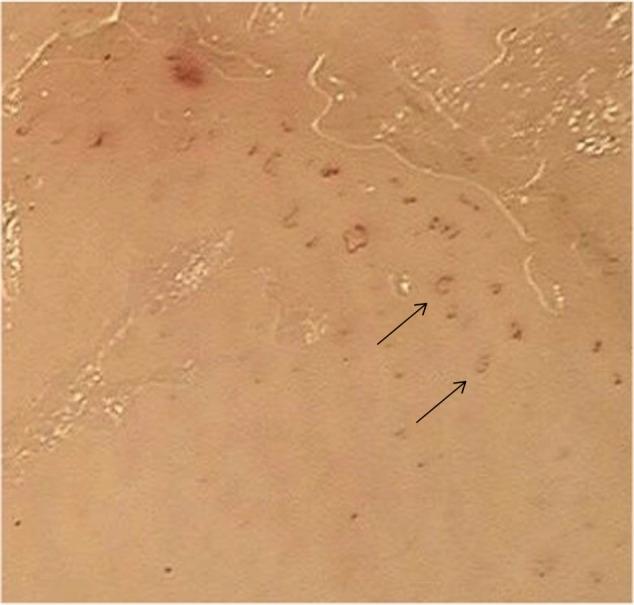 https://cdn.ncbi.nlm.nih.gov/pmc/blobs/51b8/5683109/10e17c6b2ab9/ptt-5-025Fig5.jpg