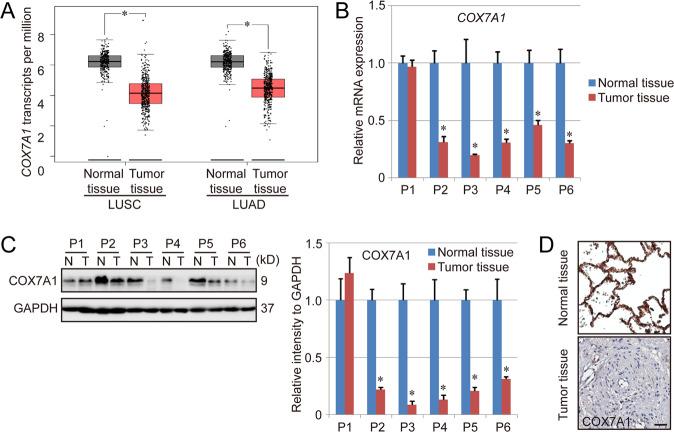 https://cdn.ncbi.nlm.nih.gov/pmc/blobs/51bc/9684511/8e3327208b2d/41419_2022_5430_Fig1_HTML.jpg