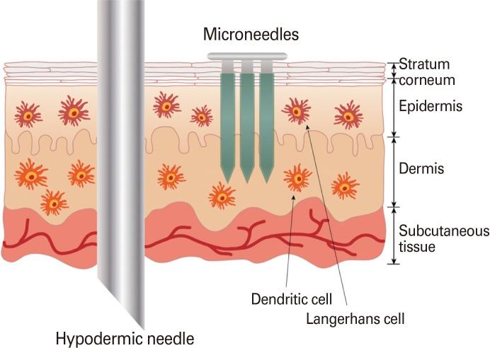 https://cdn.ncbi.nlm.nih.gov/pmc/blobs/51be/3890449/5cccfe37fc75/cevr-3-42-g001.jpg