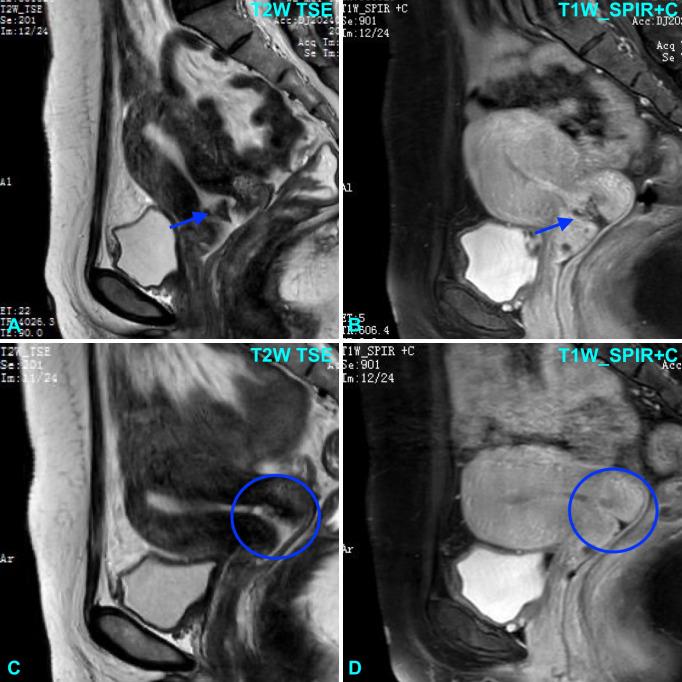 https://cdn.ncbi.nlm.nih.gov/pmc/blobs/51c1/12420282/3f2dbabb321f/fonc-15-1608856-g001.jpg