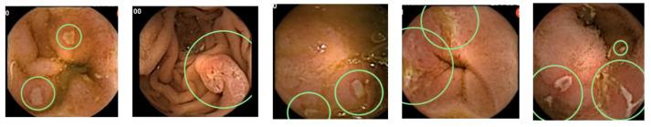 https://cdn.ncbi.nlm.nih.gov/pmc/blobs/51c7/8534609/58aced79e0c2/diagnostics-11-01737-g002.jpg