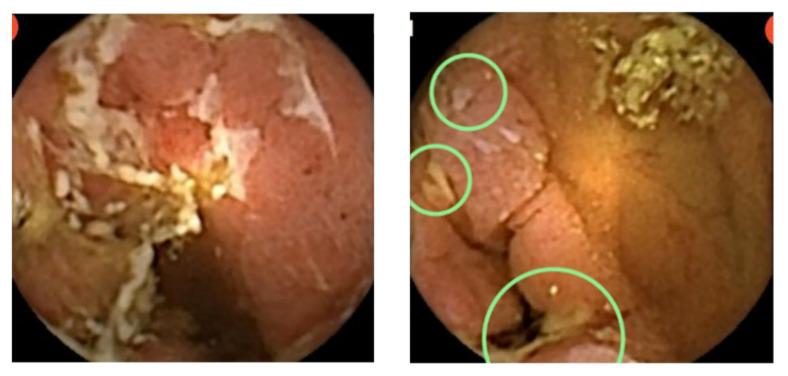 https://cdn.ncbi.nlm.nih.gov/pmc/blobs/51c7/8534609/736ec8dfa2c7/diagnostics-11-01737-g003.jpg