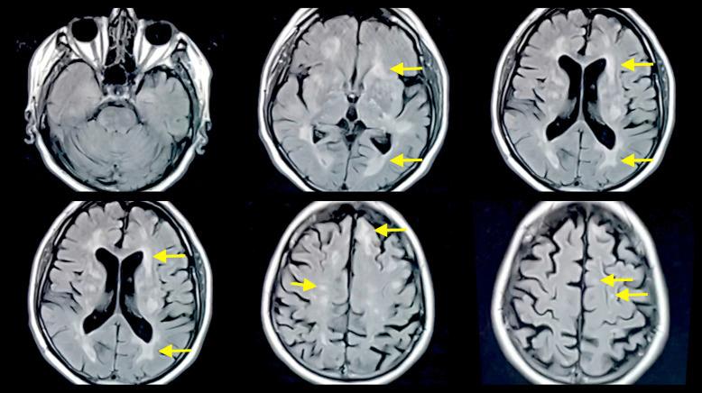 https://cdn.ncbi.nlm.nih.gov/pmc/blobs/51c8/11521480/47f0e29579e8/crn-2024-0016-0001-540951_F01.jpg