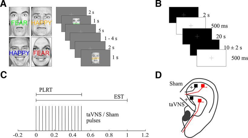 https://cdn.ncbi.nlm.nih.gov/pmc/blobs/51cd/10490471/62132a24642c/SN-JNSJ230510F001.jpg