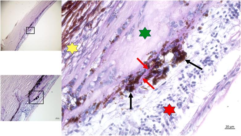 https://cdn.ncbi.nlm.nih.gov/pmc/blobs/51cd/12395167/c538210adc16/gr2.jpg