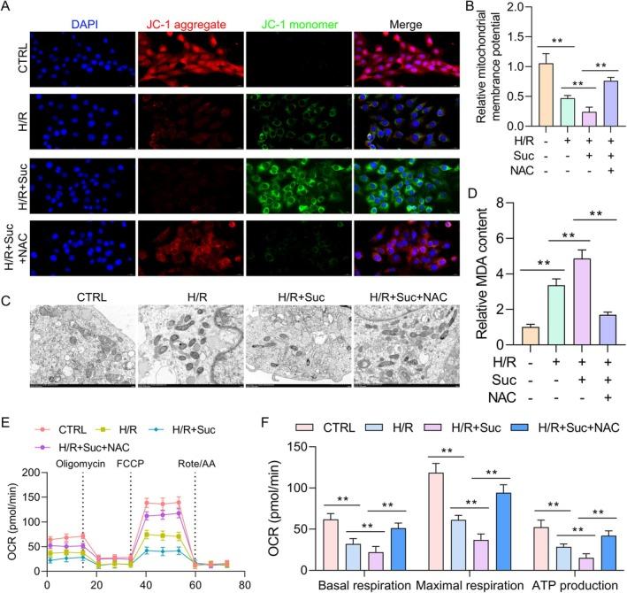 https://cdn.ncbi.nlm.nih.gov/pmc/blobs/51ce/12146119/259adeac9b15/JCMM-29-e70645-g003.jpg