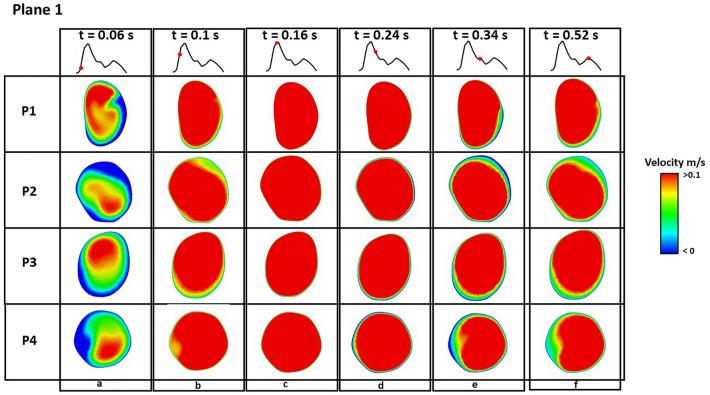 https://cdn.ncbi.nlm.nih.gov/pmc/blobs/51d1/10372056/7ffdbcb27247/41598_2023_39130_Fig4_HTML.jpg