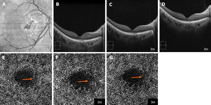 https://cdn.ncbi.nlm.nih.gov/pmc/blobs/51d3/11263065/891df92d2320/WJCC-12-5775-g003.jpg