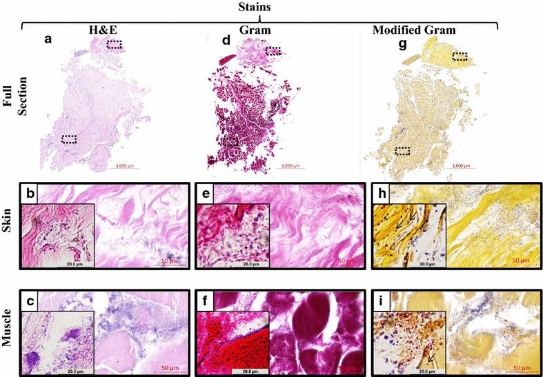 https://cdn.ncbi.nlm.nih.gov/pmc/blobs/51d4/4828829/d4bd81137d97/13104_2016_1902_Fig5_HTML.jpg