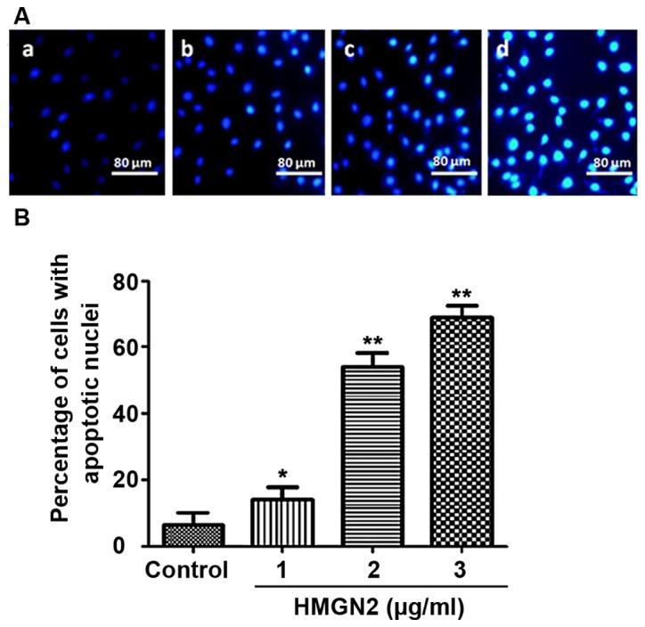 https://cdn.ncbi.nlm.nih.gov/pmc/blobs/51d4/6312954/902b4e9f2646/ol-17-01-1160-g03.jpg