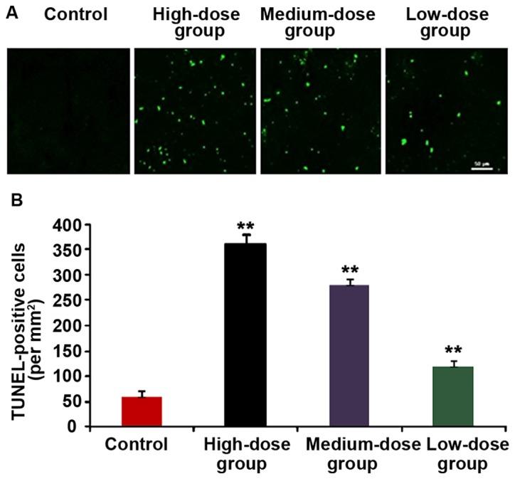 https://cdn.ncbi.nlm.nih.gov/pmc/blobs/51d4/6312954/d88c58d3195c/ol-17-01-1160-g07.jpg