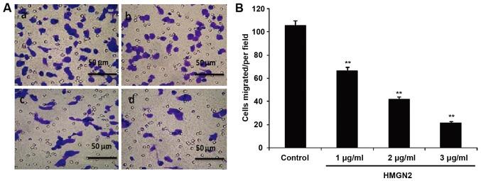 https://cdn.ncbi.nlm.nih.gov/pmc/blobs/51d4/6312954/e5eb44f94e7f/ol-17-01-1160-g01.jpg
