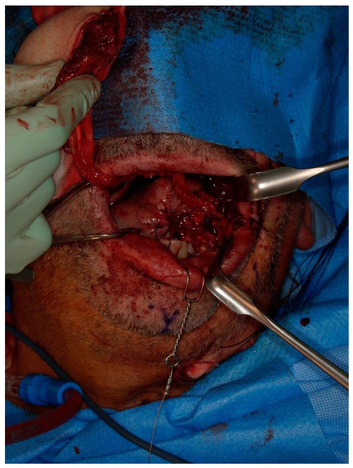 https://cdn.ncbi.nlm.nih.gov/pmc/blobs/51de/10672123/73e4d624327b/jcm-12-07064-g002.jpg