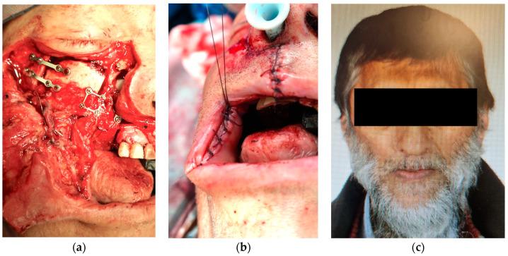 https://cdn.ncbi.nlm.nih.gov/pmc/blobs/51de/10672123/77b627e6790a/jcm-12-07064-g003.jpg