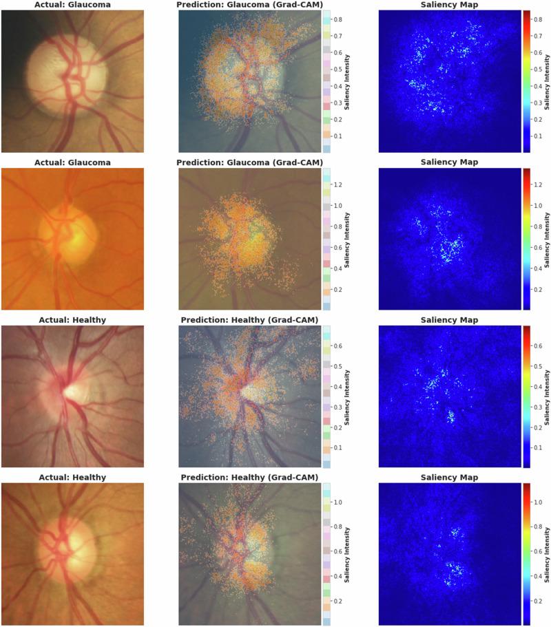 https://cdn.ncbi.nlm.nih.gov/pmc/blobs/51e3/11732976/2397248c6c0b/41433_2024_3388_Fig3_HTML.jpg