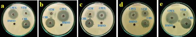 https://cdn.ncbi.nlm.nih.gov/pmc/blobs/51e4/11698845/fe4996f773d6/41598_2024_76475_Fig15_HTML.jpg