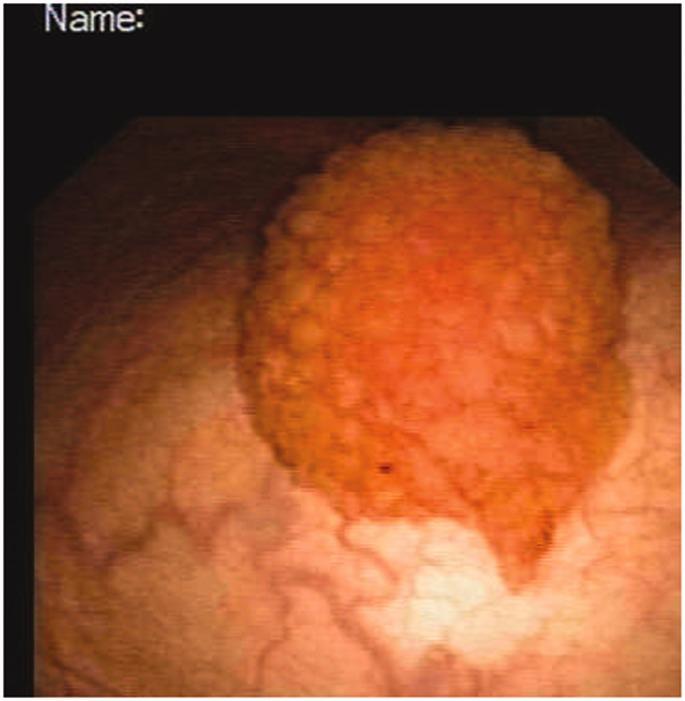 https://cdn.ncbi.nlm.nih.gov/pmc/blobs/51e6/6460601/f3719ca0ca6e/10.1177_0300060519828122-fig1.jpg