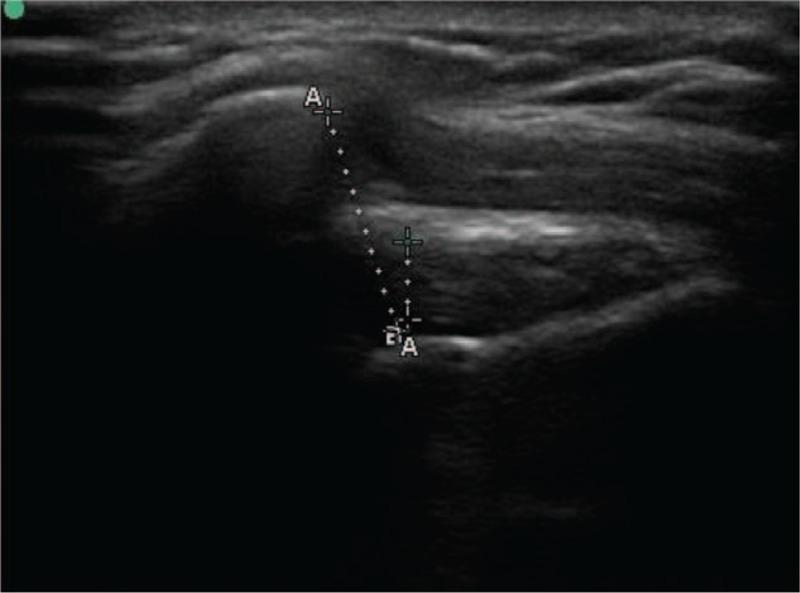 https://cdn.ncbi.nlm.nih.gov/pmc/blobs/51ed/10545080/967a3721c362/medi-100-e24734-g002.jpg