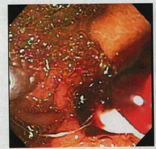 https://cdn.ncbi.nlm.nih.gov/pmc/blobs/51ee/3038954/056c8c370879/1752-1947-5-26-5.jpg