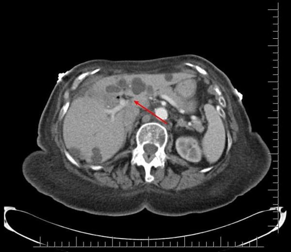 https://cdn.ncbi.nlm.nih.gov/pmc/blobs/51ee/3038954/2c1668c44483/1752-1947-5-26-1.jpg