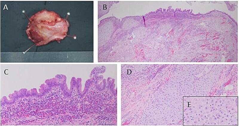 https://cdn.ncbi.nlm.nih.gov/pmc/blobs/51f0/12140097/ceda406a659d/rjaf375f3.jpg