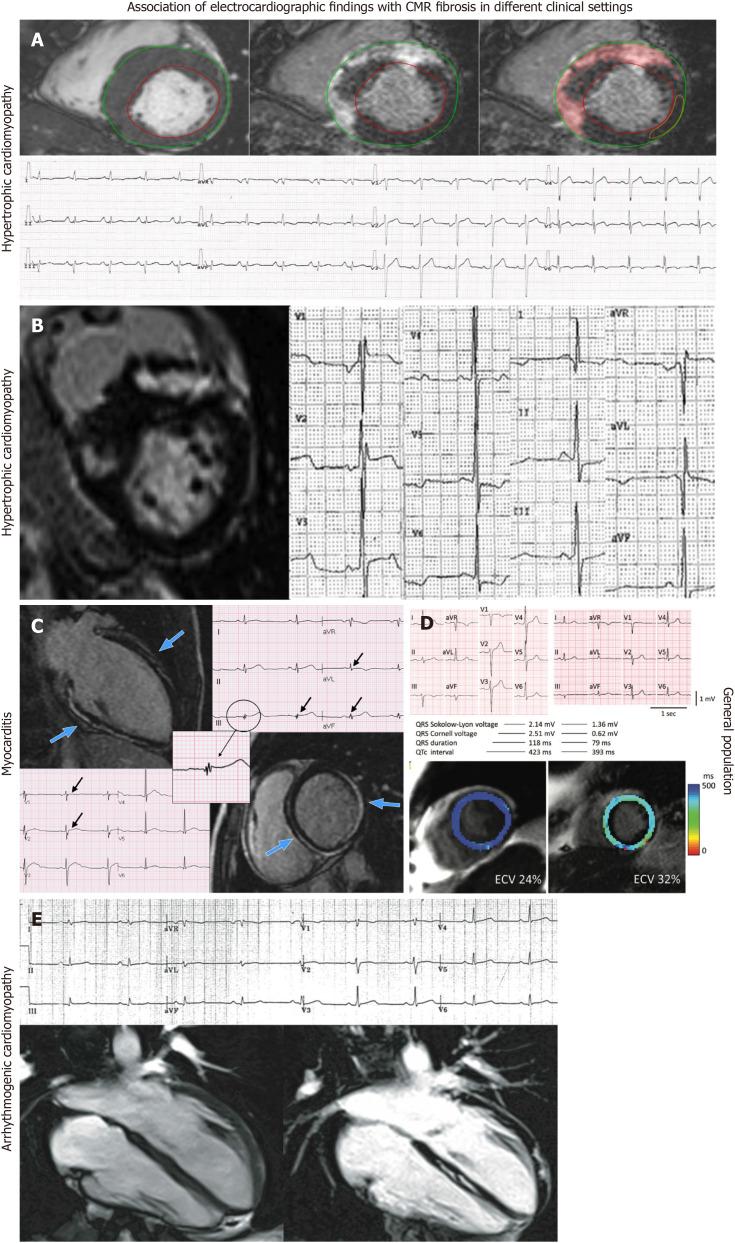 https://cdn.ncbi.nlm.nih.gov/pmc/blobs/51f0/9523270/4b8f5efc6773/WJC-14-483-g002.jpg