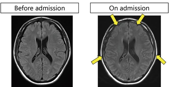 https://cdn.ncbi.nlm.nih.gov/pmc/blobs/51f1/11116002/344c995f6cf4/1349-7235-63-1261-g003.jpg