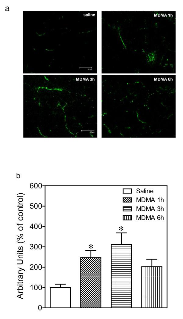 https://cdn.ncbi.nlm.nih.gov/pmc/blobs/51f1/3113340/c86f789e0c3c/1742-2094-8-53-7.jpg