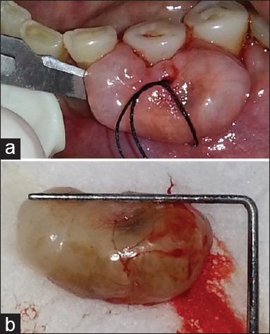https://cdn.ncbi.nlm.nih.gov/pmc/blobs/51fc/4645549/12c1216835ec/JISP-19-586-g004.jpg
