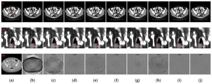 https://cdn.ncbi.nlm.nih.gov/pmc/blobs/51ff/11154272/7f2aed884e15/tomography-10-00011-g011.jpg