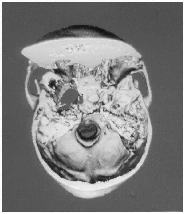 https://cdn.ncbi.nlm.nih.gov/pmc/blobs/51ff/4113538/75efdb0aad23/ETM-08-03-0877-g04.jpg