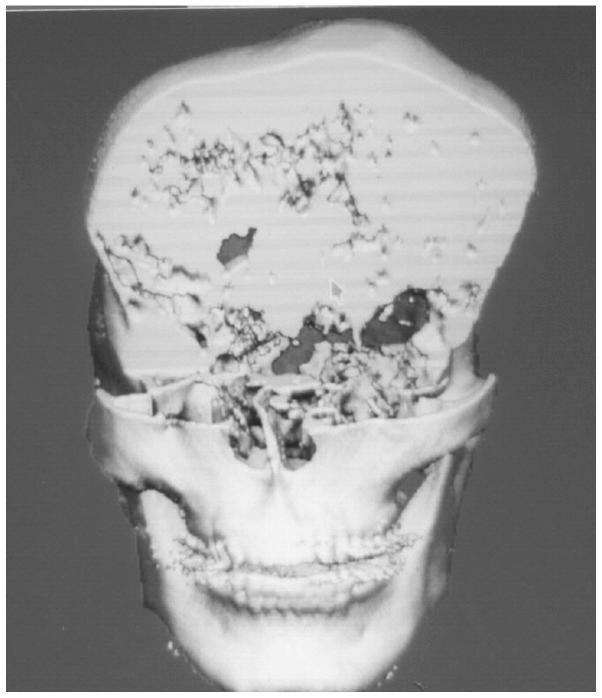https://cdn.ncbi.nlm.nih.gov/pmc/blobs/51ff/4113538/7dcf81bfb197/ETM-08-03-0877-g05.jpg
