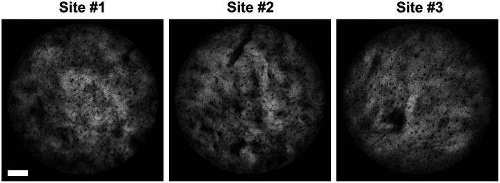 https://cdn.ncbi.nlm.nih.gov/pmc/blobs/5206/11107336/aa254ad1d845/JBO-029-050501-g003.jpg