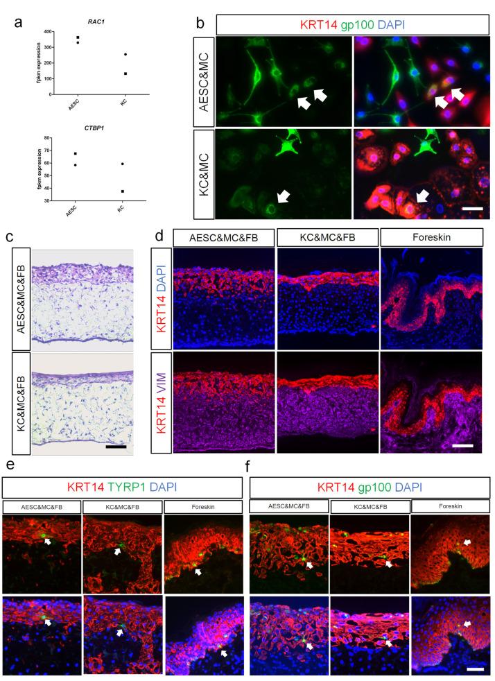 https://cdn.ncbi.nlm.nih.gov/pmc/blobs/5207/8750621/7ce1d8a8ab2c/cells-11-00070-g004.jpg