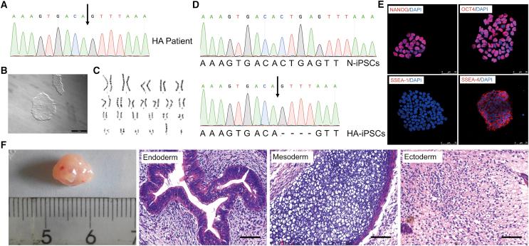 https://cdn.ncbi.nlm.nih.gov/pmc/blobs/5209/6610636/dc680a054c11/gr1.jpg
