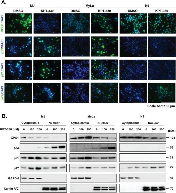 https://cdn.ncbi.nlm.nih.gov/pmc/blobs/520b/11039474/b72dc81af51c/41598_2024_59994_Fig4_HTML.jpg