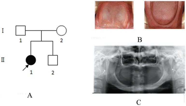 https://cdn.ncbi.nlm.nih.gov/pmc/blobs/5212/3881902/cffcfd505208/jaos-21-03-0256-g01.jpg