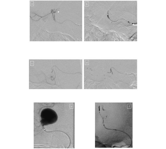 https://cdn.ncbi.nlm.nih.gov/pmc/blobs/5215/7548258/00a2d6c9eb14/2186-3326-82-0557-g004.jpg